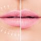 dhbelleza-resultado-labios